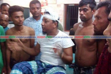 মাদারীপুরে ঘরের জানালা ভেঙে পৌরসভার মেয়রকে কুপিয়ে জখম