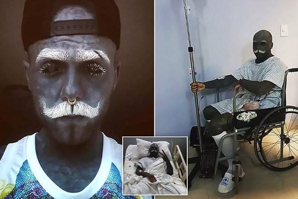 সারা শরীরে উল্কি আঁকতে গোপনাঙ্গ কেটে বাদ দিলেন এই ব্যক্তি!