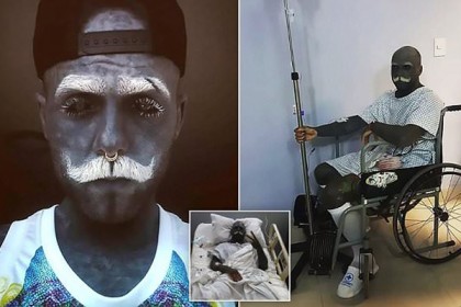 সারা শরীরে উল্কি আঁকতে গোপনাঙ্গ কেটে বাদ দিলেন এই ব্যক্তি!
