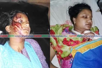 ঝিনাইদহে স্বামীর হাসুয়ার কোপে স্ত্রীসহ আহত ৩