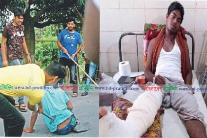হাসপাতালে কাতরাচ্ছেন কোটা আন্দোলনে আহত সেই তরিকুল

