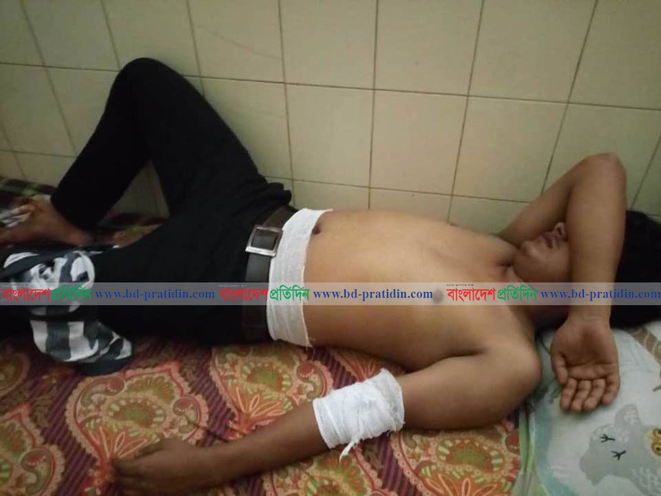 বেরোবিতে কোটা সংস্কার আন্দোলনকারীদের ওপর হামলায় আহত ৫