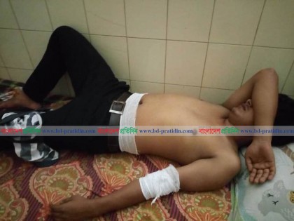 বেরোবিতে কোটা সংস্কার আন্দোলনকারীদের ওপর হামলায় আহত ৫