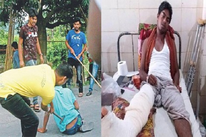 দ্বিতীয় অপারেশনে সুস্থ হয়ে উঠছেন তরিকুল