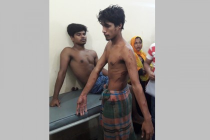 নোয়াখালীতে সন্ত্রাসী হামলায় তিন সহোদরসহ গুলিবিদ্ধ  ৯

