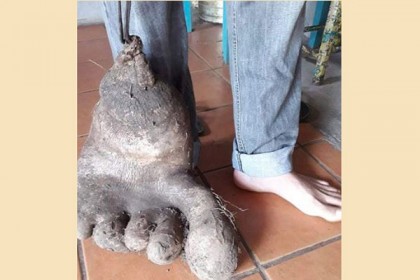 মাটি খুঁড়তেই এক দানবীয় পা!

