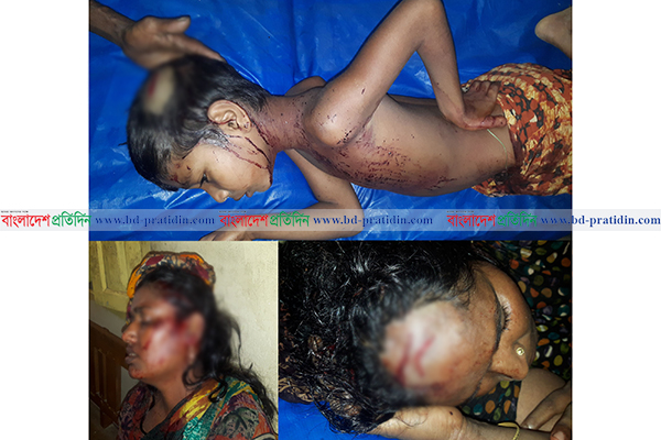 লামায় তুচ্ছ ঘটনায় শিশুসহ তিনজনকে কুপিয়ে জখম
