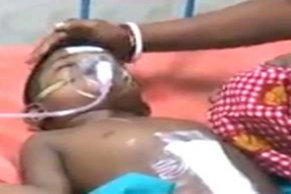 অস্ত্রোপচারের পর শিশুর পেটে পাওয়া গেল ২০৩ টি কুলের বীজ!