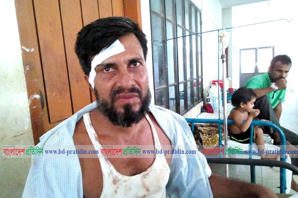 কলাপাড়ায় তুচ্ছ ঘটনাকে কেন্দ্র করে স্কুল শিক্ষককে জখম
