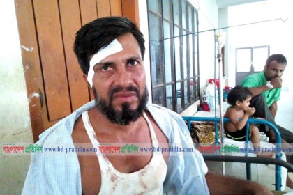 কলাপাড়ায় তুচ্ছ ঘটনাকে কেন্দ্র করে স্কুল শিক্ষককে জখম
