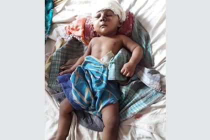 বাসের ধাক্কায় মায়ের কোল থেকে ছিটকে পড়া সেই শিশুর মৃত্যু