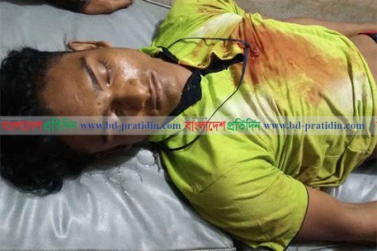 মাদক ধরিয়ে দেওয়ায় রোহিঙ্গা যুবককে গুলি করে হত্যা
