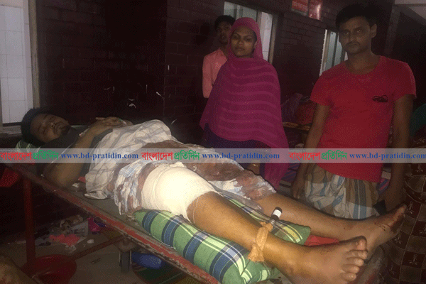 আশুলিয়ায় চাঁদা না দেওয়ায় ঠিকাদারের পায়ে গুলি