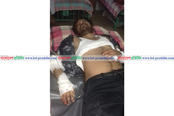 নাটোরে স্বেচ্ছাসেবক দল নেতার হাতের রগ কেটে দিল সন্ত্রাসীরা