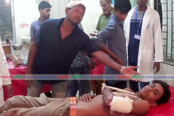 লক্ষ্মীপুরে খেলায় পরাজিত হয়ে হামলা, আহত ১৫