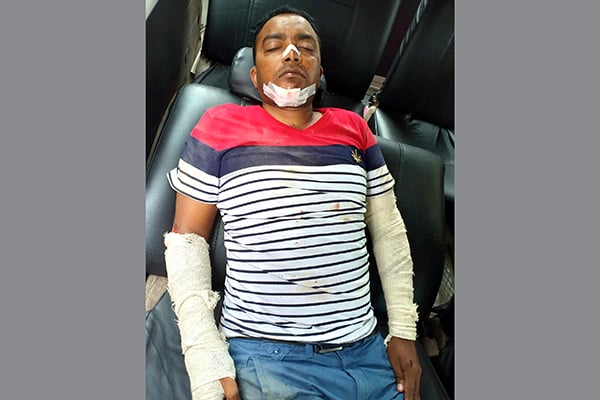 কলাপাড়ায় সড়ক দুর্ঘটনায় সাংবাদিক মিরন আহত