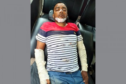 কলাপাড়ায় সড়ক দুর্ঘটনায় সাংবাদিক মিরন আহত