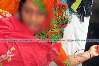 মোরেলগঞ্জে শাশুড়ির বিরুদ্ধে পুত্রবধূকে নির্যাতনের অভিযোগ