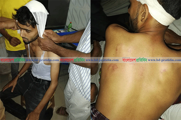নাটোরে ফুটবল খেলাকে কেন্দ্র করে সংঘর্ষ, আহত ৫