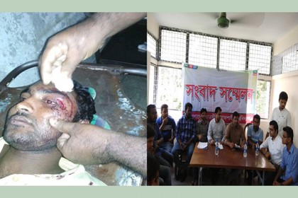 রাবিতে শিক্ষার্থীকে মারধরের অভিযোগ অস্বীকার ছাত্রলীগের