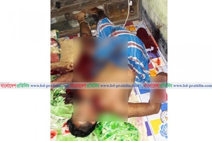 টেকনাফে বড় ভাইয়ের হাতে ছোট ভাই খুন