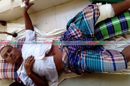 রাজশাহীতে বন্দুকযুদ্ধে মাদক ব্যবসায়ী গুলিবিদ্ধ