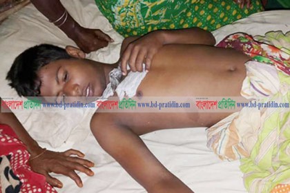 
পা হারাতে বসা এতিম শিশু মনির বাঁচতে চায়
