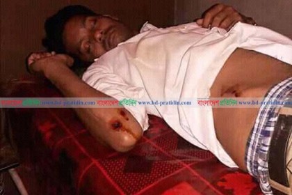 কুমিল্লায় যাত্রীবেশী ছিনতাইকারীর হামলায় সাংবাদিক গুরুতর আহত
