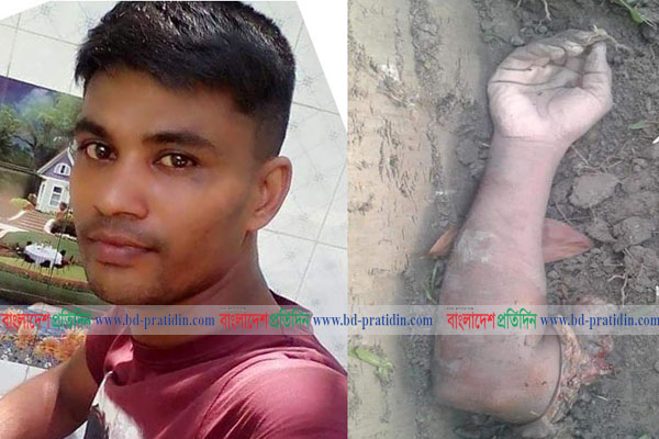 কুমিল্লায় চুরির অভিযোগে যুবকের হাত কর্তন!
