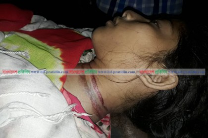 কক্সবাজারে টমটমে ওড়না পেঁচিয়ে আরও এক স্কুলছাত্রী নিহত