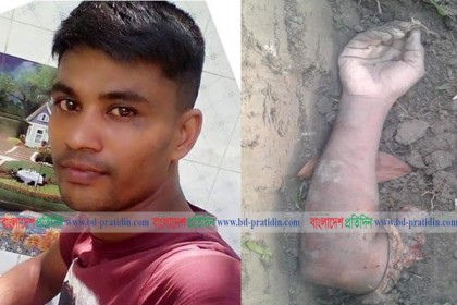 কুমিল্লায় চুরির অভিযোগে যুবকের হাত কর্তন!
