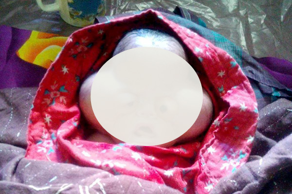 পিরোজপুরে তিন মাথা সাদৃশ্য অদ্ভুত শিশুর জন্ম 

