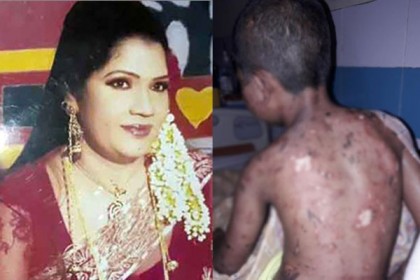 ফেনীতে শিশুর ওপর বর্বরতার ঘটনায় পালক মা আটক