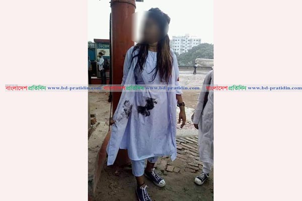 এবার গাড়ি আটকিয়ে ছাত্রীদের গায়ে পোড়া মবিল শ্রমিকদের