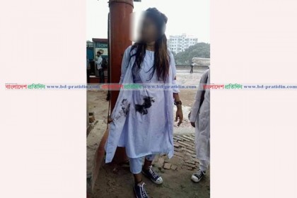 এবার গাড়ি আটকিয়ে ছাত্রীদের গায়ে পোড়া মবিল শ্রমিকদের
