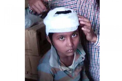 মোরেলগঞ্জে শিশু ছাত্রীর মাথা ফাটিয়ে দিলেন শিক্ষক!