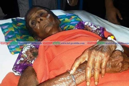 রাতে রাস্তায় ফেলে যাওয়া সেই বৃদ্ধাকে বাঁচানো গেল না