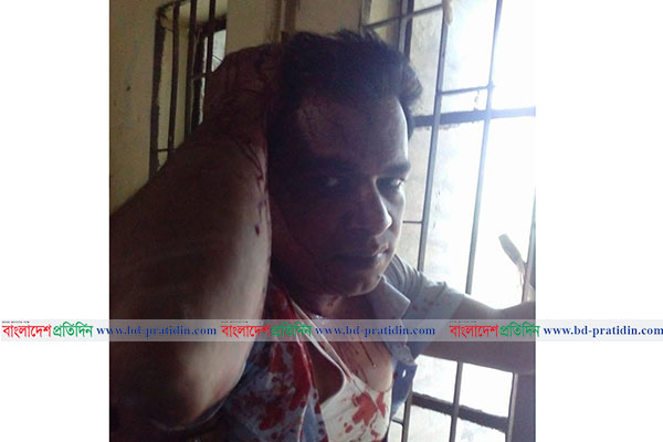 বাগাতিপাড়ায় পাওনা টাকার জেরে পোলট্রি মালিককে পিটুনি