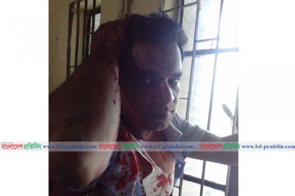 বাগাতিপাড়ায় পাওনা টাকার জেরে পোলট্রি মালিককে পিটুনি