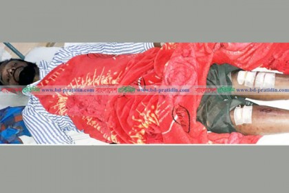 প্রভাষককে হাতুড়ি পেটা ছাত্রলীগ নেতার

