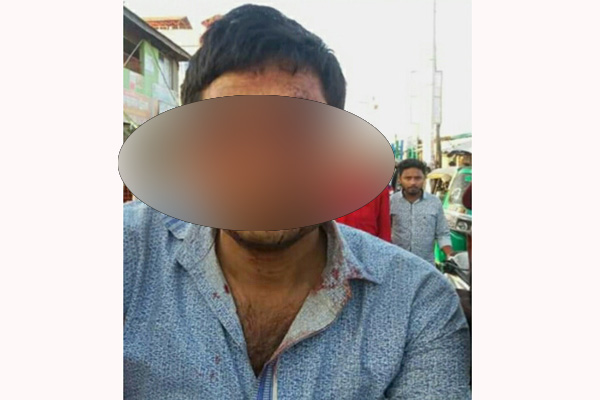 ছুরিকাঘাতে চাচার দুই চোখ নষ্ট করল ভাতিজা