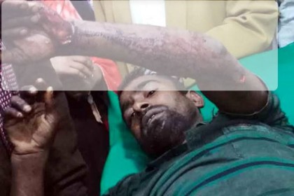 সুন্দরবনে বাঘের সঙ্গে লড়াই করে প্রাণে বাঁচলেন তিনি

