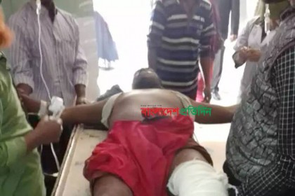 ৭২ ঘণ্টা পেরিয়ে গেলেও কেটে নেওয়া পা উদ্ধার হয়নি
