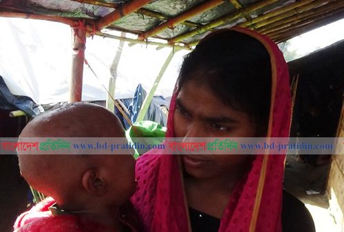 রোহিঙ্গা ক্যাম্পগুলোতে ছোঁয়াচে রোগের প্রাদুর্ভাব