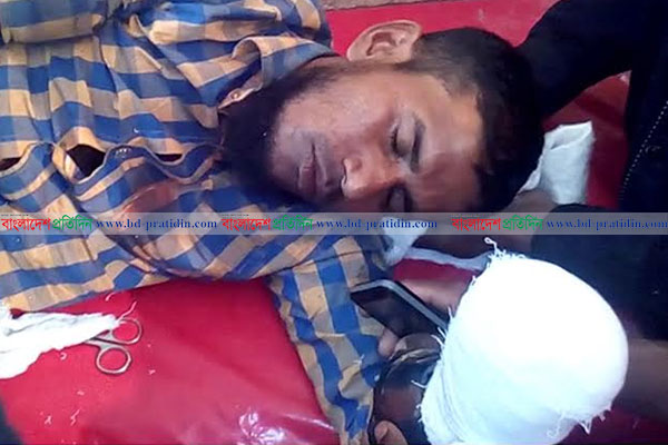 কলাপাড়ায় এক কৃষকের হাত কেটে নিল অপর কৃষক