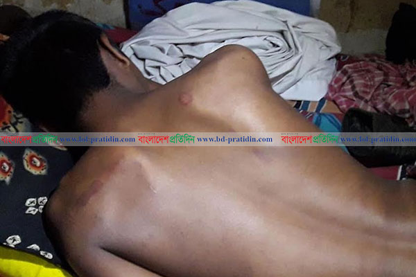 মোবাইল চুরির অভিযোগে ছাত্রকে হাত-পা বেঁধে পিটুনি