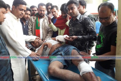 ছাত্রলীগ নেতার হাত-পা ভেঙে দিয়েছে স্বতন্ত্র প্রার্থীর কর্মীরা 