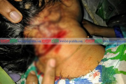 কলাপাড়ায় ছুরিকাঘাতে কলেজ শিক্ষিকা গুরুতর জখম