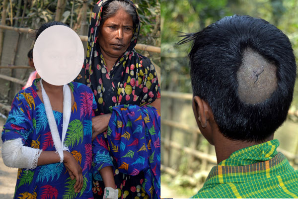 কুমিল্লায় আওয়ামী লীগ বিদ্রোহীর সমর্থকদের বাড়িতে হামলা

