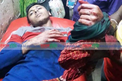 বরিশালে ডিপ্লোমা প্রকৌশলীর ওপর হামলা, হাতের কব্জি বিচ্ছিন্ন 